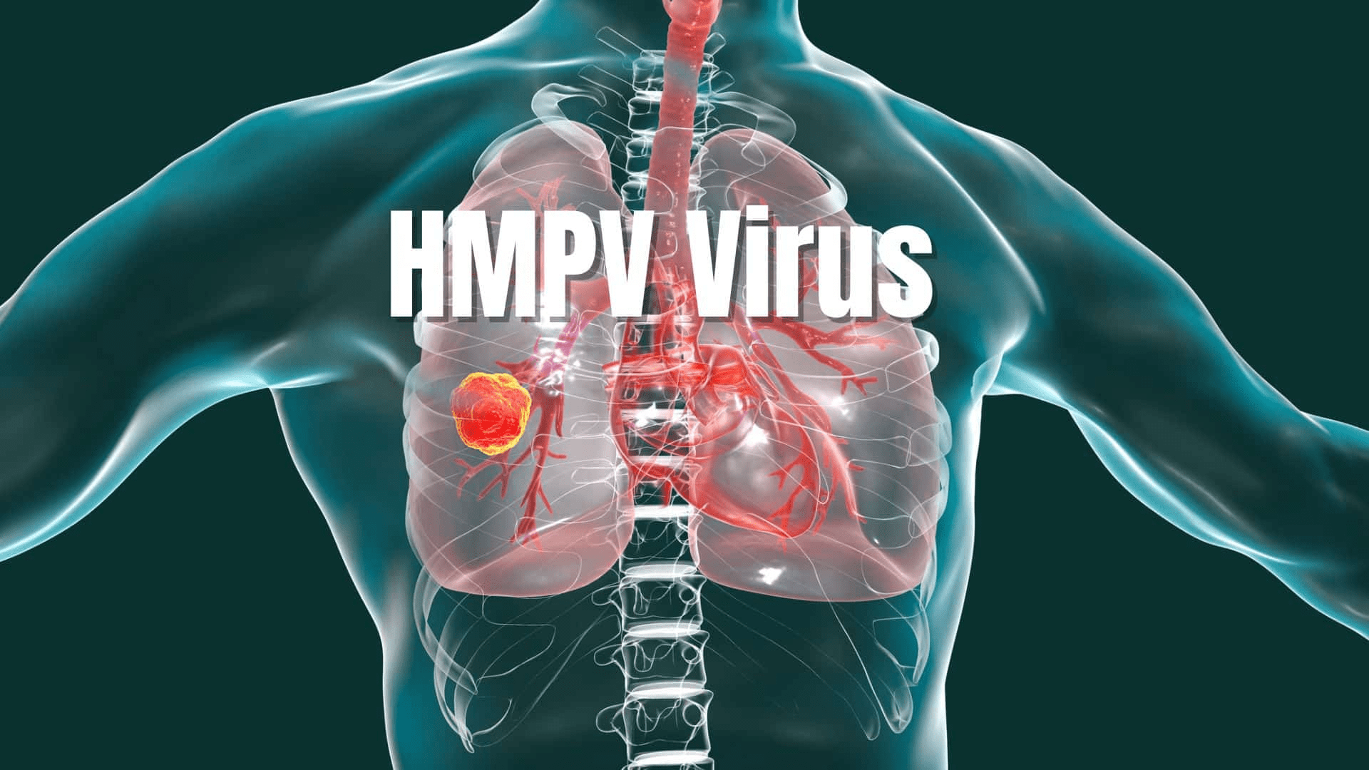 Human Metapneumovirus (HMPV) Symptoms, Diagnosis, and Treatment